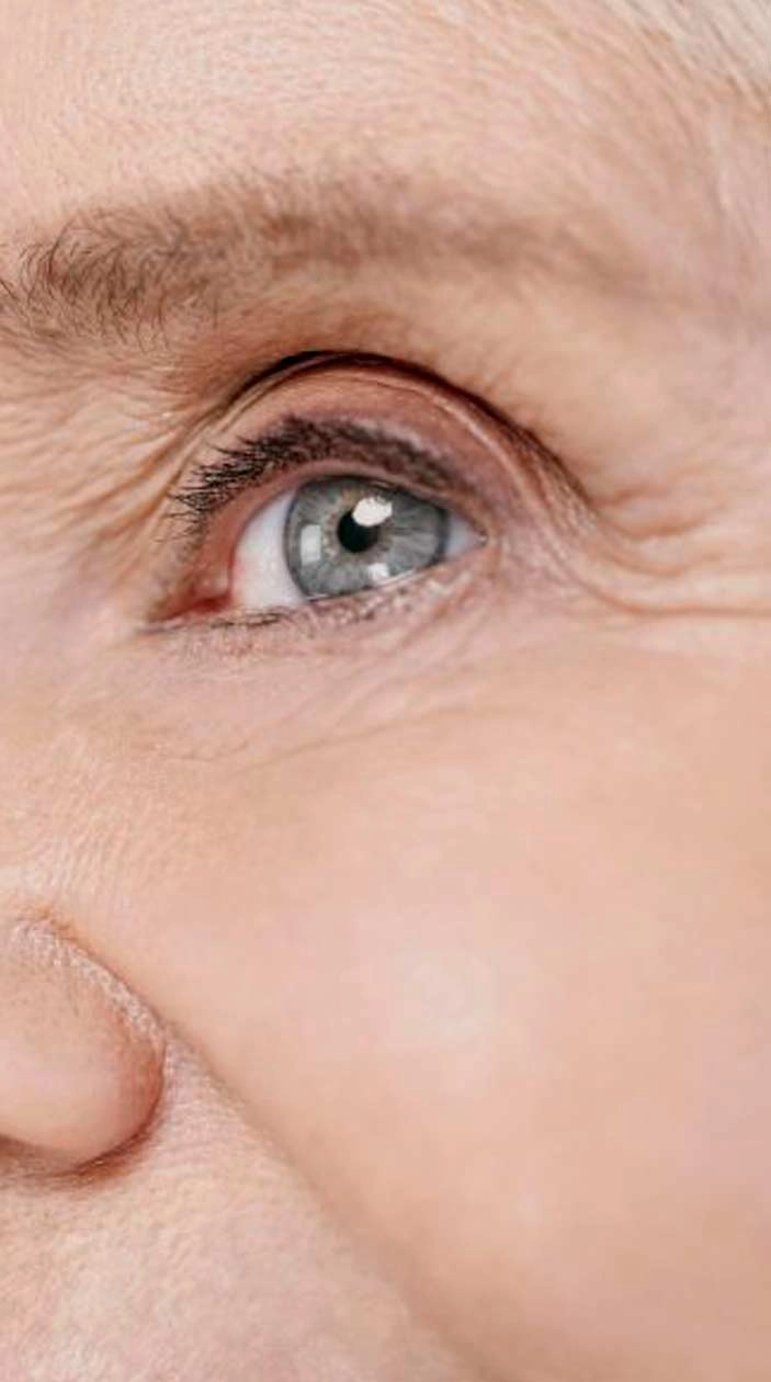 blefaroplastia