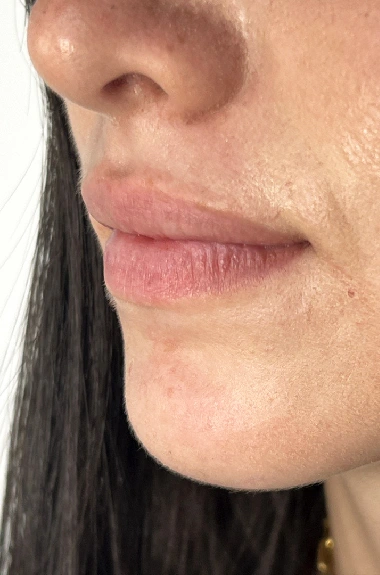 Micropigmentación de Labios antes