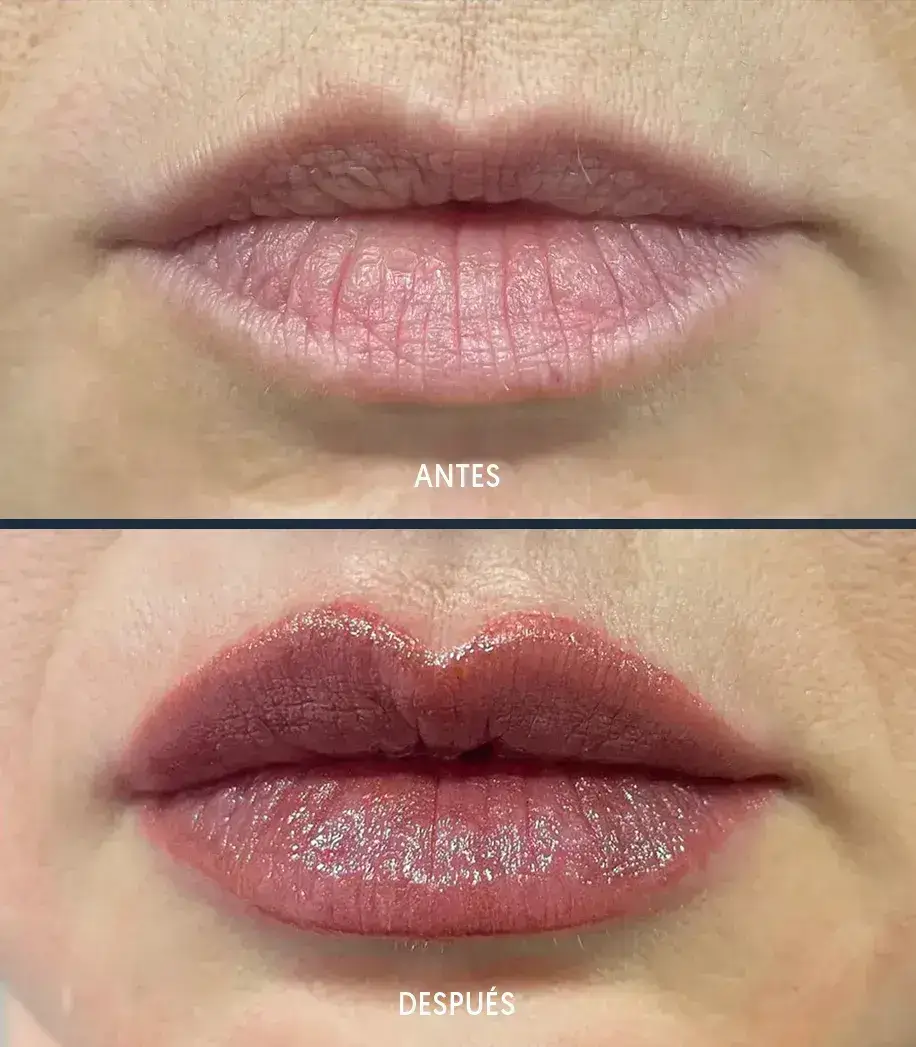 Micropigmentación labios