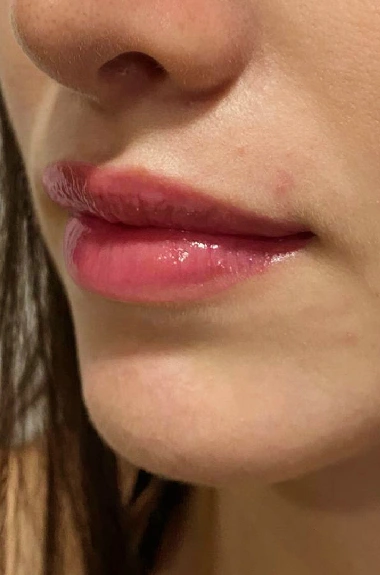 Micropigmentación de Labios